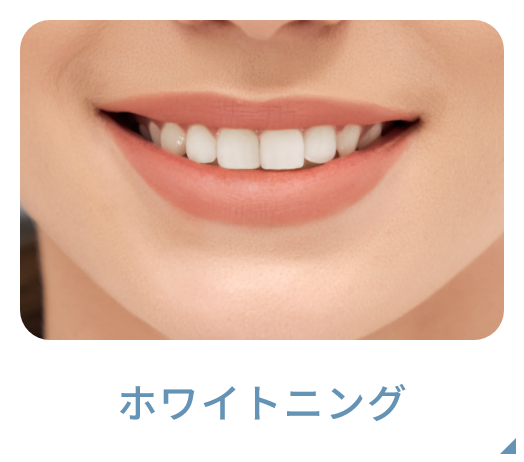 ホワイトニング